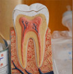 虎牙矫正的副作用